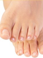Common Rashes of the Feet