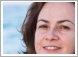 Skin Cancer - Risk Factors