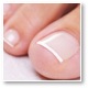 nail fungal infections