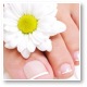 Managing Nail Infections