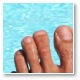 Fungal nail infections